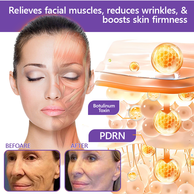 𝑵𝒆𝒚𝒆𝒓𝒐𝒔® PDRN Multi-Peptide Massaging Body Roller Cream- Anti-aging, Hydrating, Skin Firming & Lifting, Skin Repair, Even Tone, Acne and Dark Spot Treatment, Wart and Mole Removal, and Psoriasis Relief
