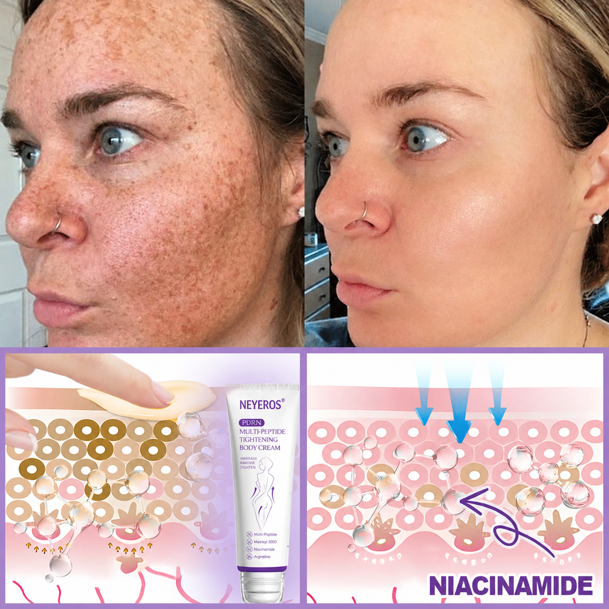 𝑵𝒆𝒚𝒆𝒓𝒐𝒔® PDRN Multi-Peptide Massaging Body Roller Cream- Anti-aging, Hydrating, Skin Firming & Lifting, Skin Repair, Even Tone, Acne and Dark Spot Treatment, Wart and Mole Removal, and Psoriasis Relief