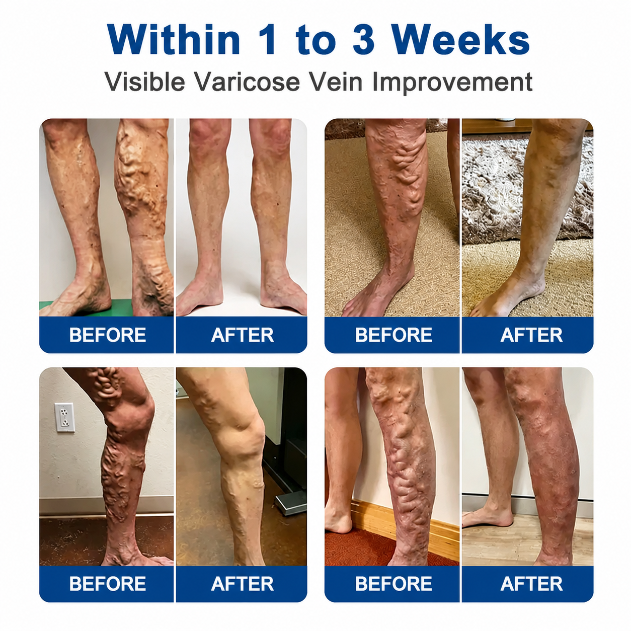 NEYEROS® VeinTarget Microneedle Patch ⚡ Fast-Acting Comfort, Long-Lasting Support