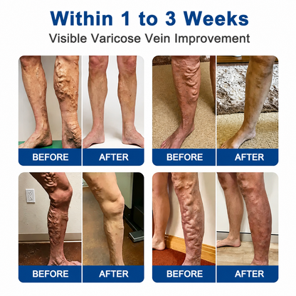 NEYEROS® VeinTarget Microneedle Patch ⚡ Fast-Acting Comfort, Long-Lasting Support