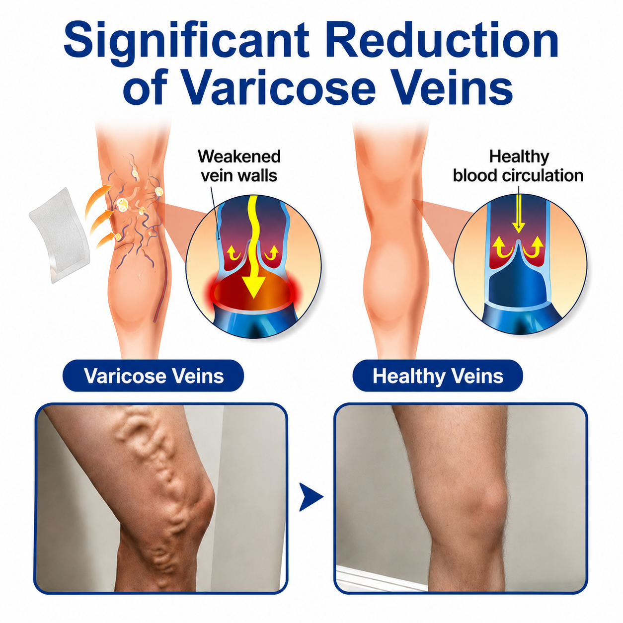 NEYEROS® VeinTarget Microneedle Patch ⚡ Fast-Acting Comfort, Long-Lasting Support
