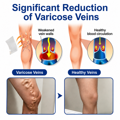 NEYEROS® VeinTarget Microneedle Patch ⚡ Fast-Acting Comfort, Long-Lasting Support