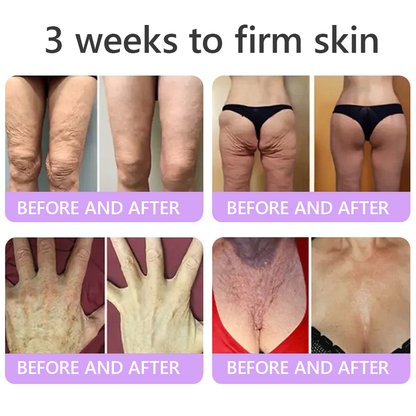 𝑵𝒆𝒚𝒆𝒓𝒐𝒔® PDRN Multi-Peptide Massaging Body Roller Cream- Anti-aging, Hydrating, Skin Firming & Lifting, Skin Repair, Even Tone, Acne and Dark Spot Treatment, Wart and Mole Removal, and Psoriasis Relief