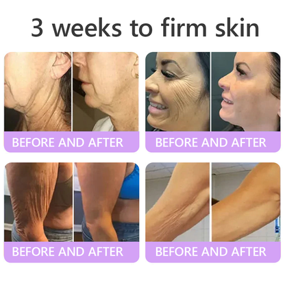 𝑵𝒆𝒚𝒆𝒓𝒐𝒔® PDRN Multi-Peptide Massaging Body Roller Cream- Anti-aging, Hydrating, Skin Firming & Lifting, Skin Repair, Even Tone, Acne and Dark Spot Treatment, Wart and Mole Removal, and Psoriasis Relief