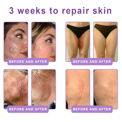 𝑵𝒆𝒚𝒆𝒓𝒐𝒔® PDRN Multi-Peptide Massaging Body Roller Cream- Anti-aging, Hydrating, Skin Firming & Lifting, Skin Repair, Even Tone, Acne and Dark Spot Treatment, Wart and Mole Removal, and Psoriasis Relief